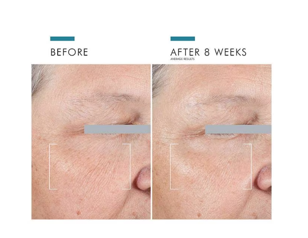 SkinCeuticals A.G.E. Advanced Eye