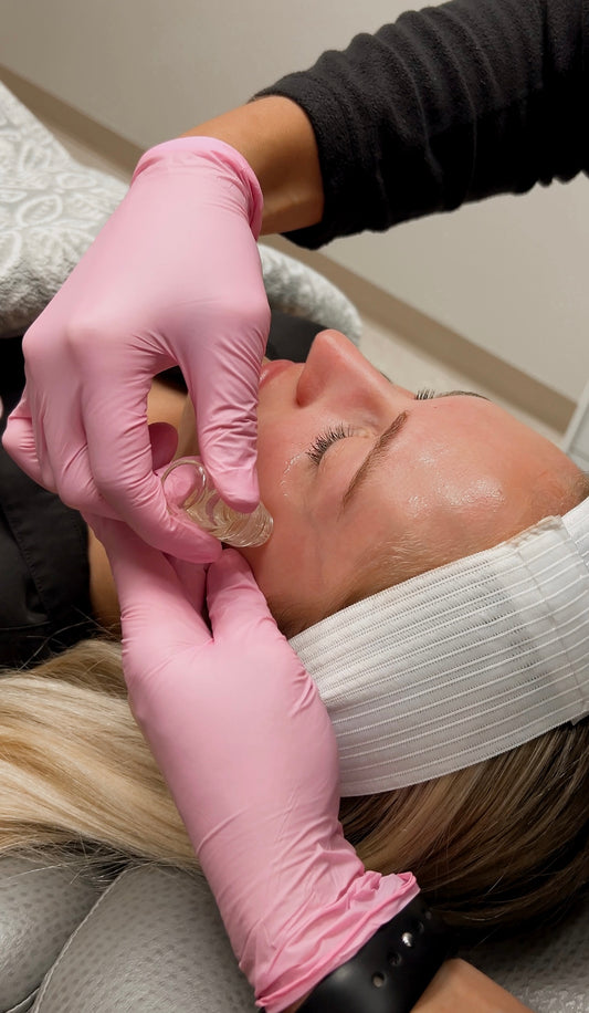 MicroChanneling Facial