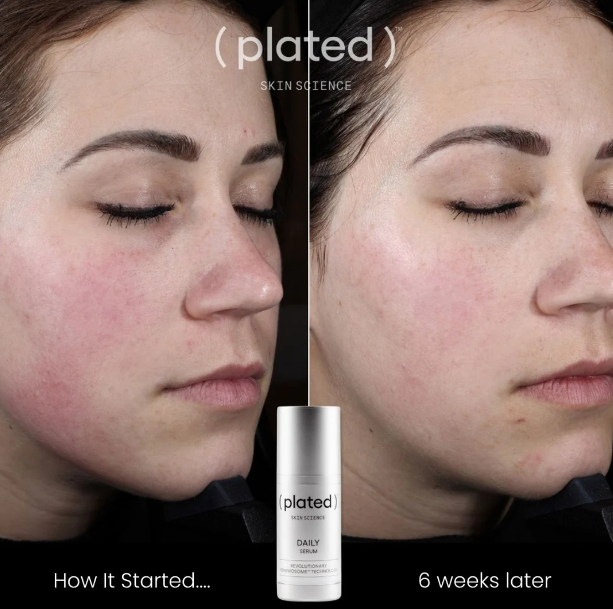 Plated DAILY Serum