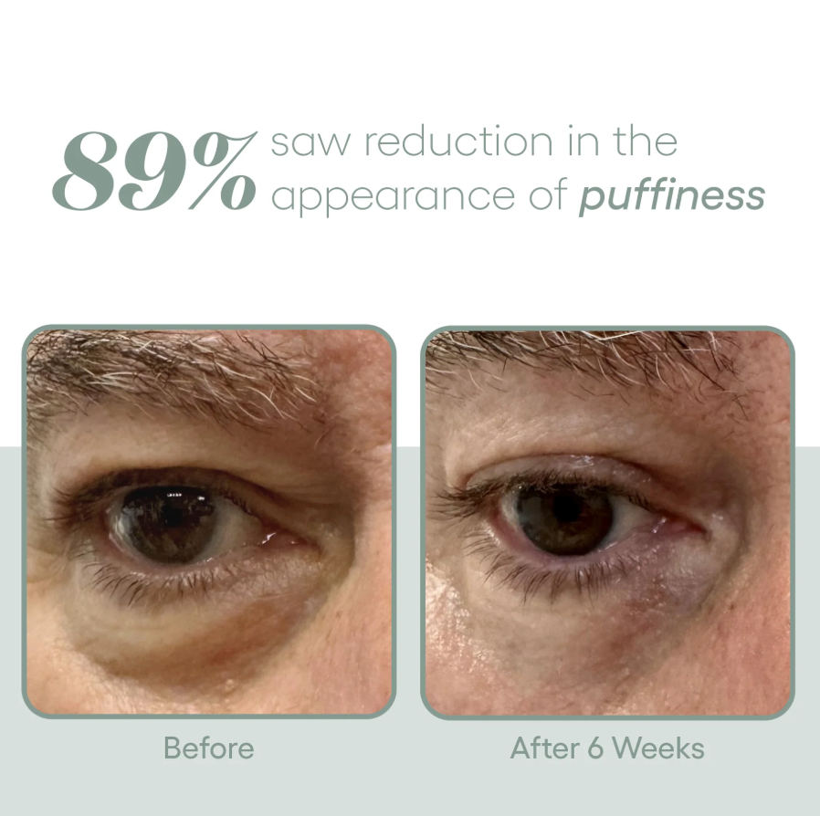 Plated Eye Serum