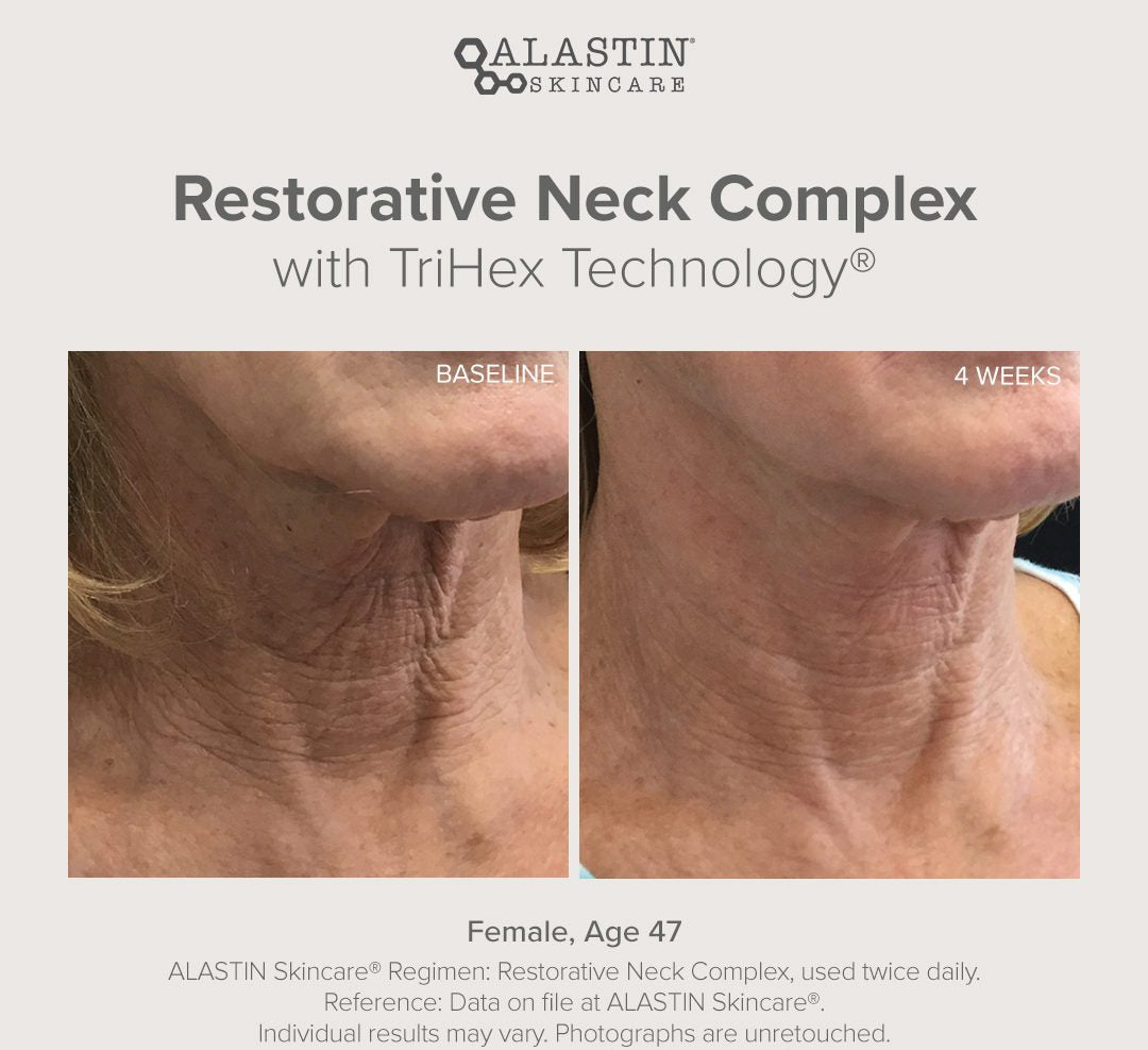 Alastin Restorative Neck Complex with TriHex Technology
